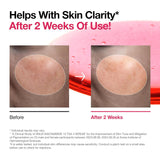 Anua Niacinamide 10% + TXA 4 Serum 30 ML