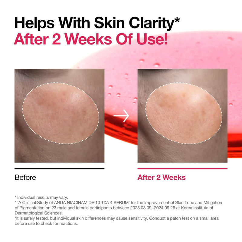 Anua Niacinamide 10%  +  TXA 4 Serum 30 ML